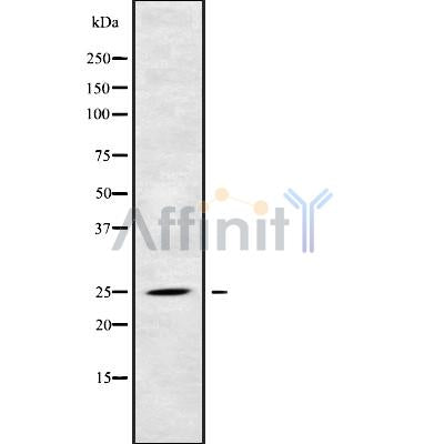 Western blot analysis of RAB39A using HeLa whole cell lysates