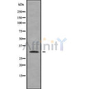 Western blot analysis of RAB40A using Jurkat whole cell lysates