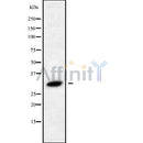 Western blot analysis of RAB40C using HeLa whole cell lysates