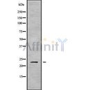 DF9833 at 1/100 staining Mouse colon tissue by IHC-P. The sample was formaldehyde fixed and a heat mediated antigen retrieval step in citrate buffer was performed. The sample was then blocked and incubated with the antibody for 1.5 hours at 22¡ãC. An HRP conjugated goat anti-rabbit antibody was used as the secondary