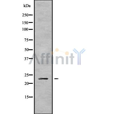 DF9833 at 1/100 staining Mouse colon tissue by IHC-P. The sample was formaldehyde fixed and a heat mediated antigen retrieval step in citrate buffer was performed. The sample was then blocked and incubated with the antibody for 1.5 hours at 22¡ãC. An HRP conjugated goat anti-rabbit antibody was used as the secondary