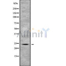 Western blot analysis of RAB5B using COLO205 whole cell lysates