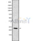 Western blot analysis of extracts from rat brain, using RAB6B Antibody. Lane 1 was treated with the blocking peptide.