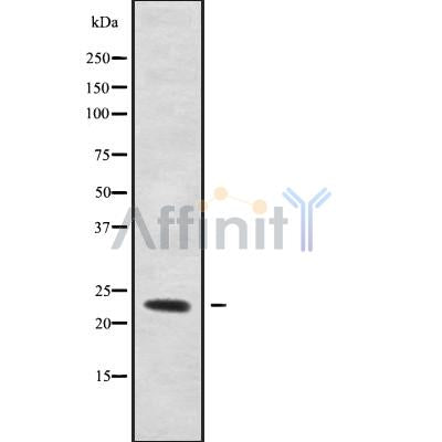 Western blot analysis of extracts from rat brain, using RAB6B Antibody. Lane 1 was treated with the blocking peptide.