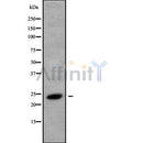 Western blot analysis of RAB8B using HeLa whole cell lysates