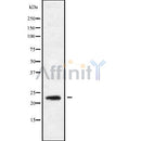 Western blot analysis of extracts from rat brain, using RAB9B Antibody. Lane 1 was treated with the blocking peptide.