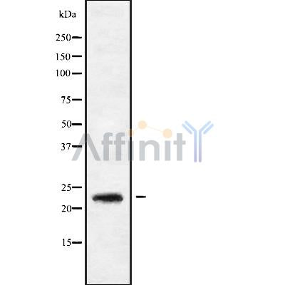Western blot analysis of extracts from rat brain, using RAB9B Antibody. Lane 1 was treated with the blocking peptide.