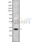 Western blot analysis of RRAS2 using HuvEc whole cell lysates