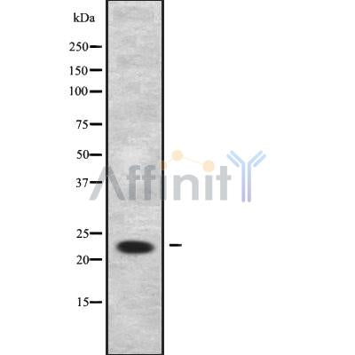 Western blot analysis of RRAS2 using HuvEc whole cell lysates