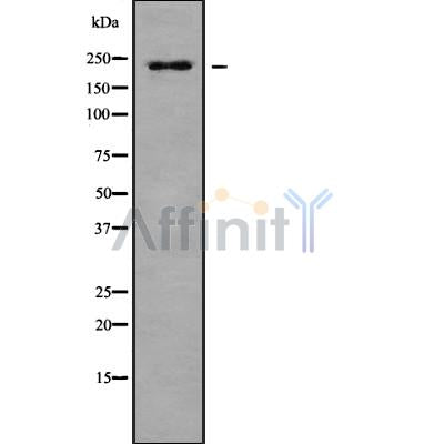 Western blot analysis of PTPRB using HuvEc whole cell lysates