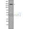 Western blot analysis of PTPRB using HuvEc whole cell lysates