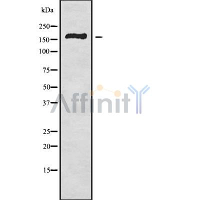 DF9842 at 1/100 staining Human liver cancer tissue by IHC-P. The sample was formaldehyde fixed and a heat mediated antigen retrieval step in citrate buffer was performed. The sample was then blocked and incubated with the antibody for 1.5 hours at 22¡ãC. An HRP conjugated goat anti-rabbit antibody was used as the secondary