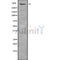 DF9843 at 1/100 staining Human Melanoma tissue by IHC-P. The sample was formaldehyde fixed and a heat mediated antigen retrieval step in citrate buffer was performed. The sample was then blocked and incubated with the antibody for 1.5 hours at 22¡ãC. An HRP conjugated goat anti-rabbit antibody was used as the secondary