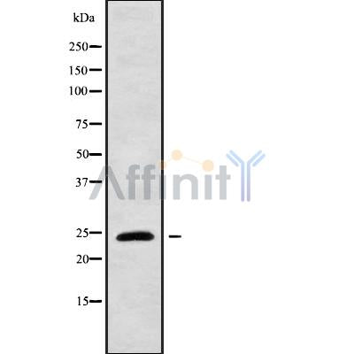 DF9844 at 1/100 staining Mouse lung tissue by IHC-P. The sample was formaldehyde fixed and a heat mediated antigen retrieval step in citrate buffer was performed. The sample was then blocked and incubated with the antibody for 1.5 hours at 22¡ãC. An HRP conjugated goat anti-rabbit antibody was used as the secondary