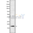 DF9847 at 1/100 staining Human Head and neck cancer tissue by IHC-P. The sample was formaldehyde fixed and a heat mediated antigen retrieval step in citrate buffer was performed. The sample was then blocked and incubated with the antibody for 1.5 hours at 22¡ãC. An HRP conjugated goat anti-rabbit antibody was used as the secondary