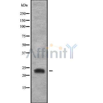 Western blot analysis of RGS4 using COS7 whole cell lysates