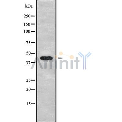 DF9850 at 1/100 staining Human gastric tissue by IHC-P. The sample was formaldehyde fixed and a heat mediated antigen retrieval step in citrate buffer was performed. The sample was then blocked and incubated with the antibody for 1.5 hours at 22¡ãC. An HRP conjugated goat anti-rabbit antibody was used as the secondary