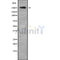 Western blot analysis of ABCA4 using HT29 whole cell lysates