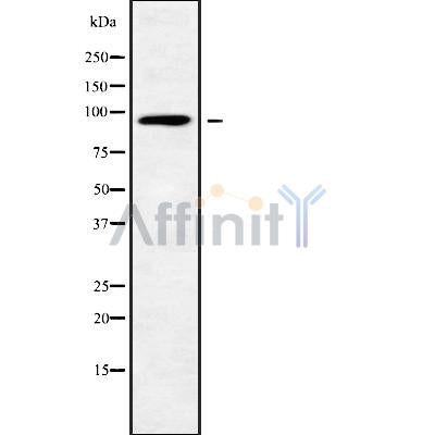 DF9855 staining Hela cells by IF/ICC. The sample were fixed with PFA and permeabilized in 0.1% Triton X-100,then blocked in 10% serum for 45 minutes at 25¡ãC. The primary antibody was diluted at 1/200 and incubated with the sample for 1 hour at 37¡ãC. An  Alexa Fluor 594 conjugated goat anti-rabbit IgG (H+L) antibody(Cat.# S0006), diluted at 1/600, was used as secondary antibod