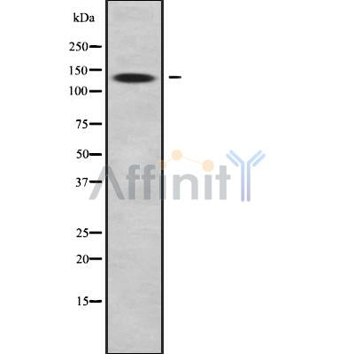 DF9856 at 1/100 staining Human brain cancer tissue by IHC-P. The sample was formaldehyde fixed and a heat mediated antigen retrieval step in citrate buffer was performed. The sample was then blocked and incubated with the antibody for 1.5 hours at 22¡ãC. An HRP conjugated goat anti-rabbit antibody was used as the secondary
