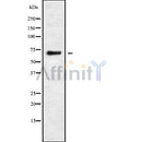 Western blot analysis of extracts from Hepg2, using RHG25 Antibody. Lane 1 was treated with the blocking peptide.