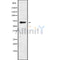 Western blot analysis of extracts from Hepg2, using RHG25 Antibody. Lane 1 was treated with the blocking peptide.