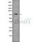 Western blot analysis of ARHGEF4 using LOVO whole cell lysates