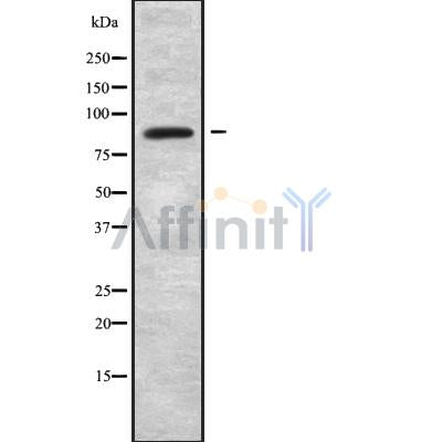 DF9865 at 1/100 staining Human breast cancer tissue by IHC-P. The sample was formaldehyde fixed and a heat mediated antigen retrieval step in citrate buffer was performed. The sample was then blocked and incubated with the antibody for 1.5 hours at 22¡ãC. An HRP conjugated goat anti-rabbit antibody was used as the secondary