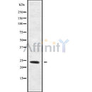 DF9866 at 1/100 staining Human prostate tissue by IHC-P. The sample was formaldehyde fixed and a heat mediated antigen retrieval step in citrate buffer was performed. The sample was then blocked and incubated with the antibody for 1.5 hours at 22¡ãC. An HRP conjugated goat anti-rabbit antibody was used as the secondary