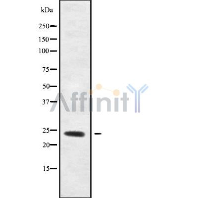 DF9866 at 1/100 staining Human prostate tissue by IHC-P. The sample was formaldehyde fixed and a heat mediated antigen retrieval step in citrate buffer was performed. The sample was then blocked and incubated with the antibody for 1.5 hours at 22¡ãC. An HRP conjugated goat anti-rabbit antibody was used as the secondary