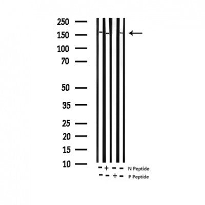 AF3152 at 1/200 staining Rat brain tissue sections by IHC-P. The tissue was formaldehyde fixed and a heat mediated antigen retrieval step in citrate buffer was performed. The tissue was then blocked and incubated with the antibody for 1.5 hours at 22¡ãC. An HRP conjugated goat anti-rabbit antibody was used as the secondary