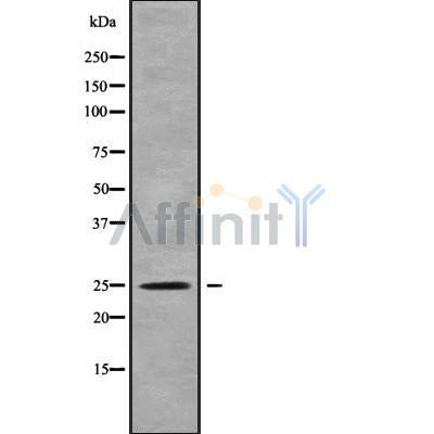 DF9867 at 1/100 staining Mouse testis tissue by IHC-P. The sample was formaldehyde fixed and a heat mediated antigen retrieval step in citrate buffer was performed. The sample was then blocked and incubated with the antibody for 1.5 hours at 22¡ãC. An HRP conjugated goat anti-rabbit antibody was used as the secondary