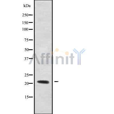 Western blot analysis of RHOXF1 using LOVO whole cell lysates