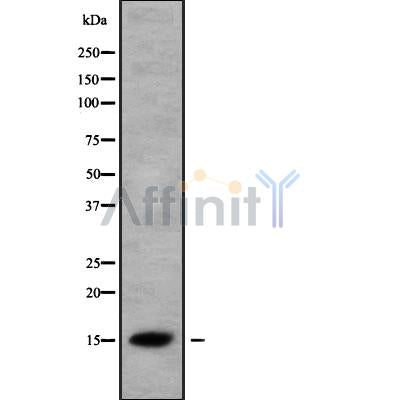DF9870 at 1/100 staining Human prostate tissue by IHC-P. The sample was formaldehyde fixed and a heat mediated antigen retrieval step in citrate buffer was performed. The sample was then blocked and incubated with the antibody for 1.5 hours at 22¡ãC. An HRP conjugated goat anti-rabbit antibody was used as the secondary