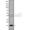 DF9870 at 1/100 staining Human prostate tissue by IHC-P. The sample was formaldehyde fixed and a heat mediated antigen retrieval step in citrate buffer was performed. The sample was then blocked and incubated with the antibody for 1.5 hours at 22¡ãC. An HRP conjugated goat anti-rabbit antibody was used as the secondary