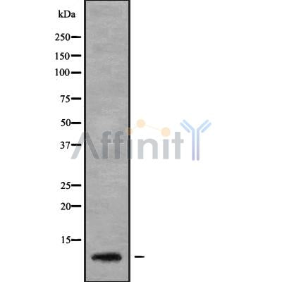 DF9873 at 1/100 staining Mouse kidney tissue by IHC-P. The sample was formaldehyde fixed and a heat mediated antigen retrieval step in citrate buffer was performed. The sample was then blocked and incubated with the antibody for 1.5 hours at 22¡ãC. An HRP conjugated goat anti-rabbit antibody was used as the secondary