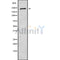 Western blot analysis of extracts from mouse brain, using CROCC Antibody.