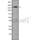 Western blot analysis of ROBO1 using MCF7 whole cell lysates