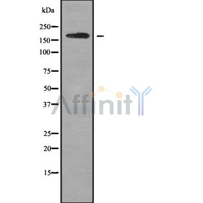 Western blot analysis of ROBO1 using MCF7 whole cell lysates