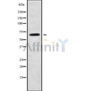 Western blot analysis SCARA3 using COLO205 whole cell lysates