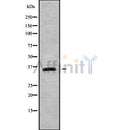 DF9879 at 1/100 staining Human Melanoma tissue by IHC-P. The sample was formaldehyde fixed and a heat mediated antigen retrieval step in citrate buffer was performed. The sample was then blocked and incubated with the antibody for 1.5 hours at 22¡ãC. An HRP conjugated goat anti-rabbit antibody was used as the secondary