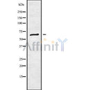 DF9888 at 1/100 staining Human prostate tissue by IHC-P. The sample was formaldehyde fixed and a heat mediated antigen retrieval step in citrate buffer was performed. The sample was then blocked and incubated with the antibody for 1.5 hours at 22¡ãC. An HRP conjugated goat anti-rabbit antibody was used as the secondary