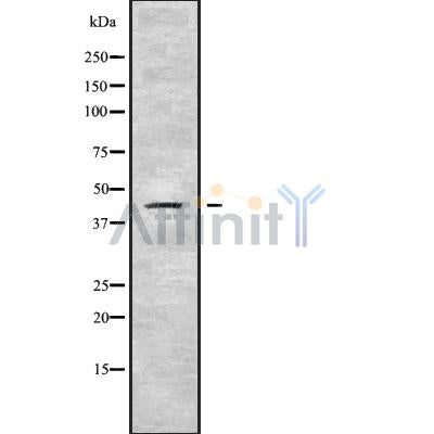 Western blot analysis SERPINB10 using LOVO whole cell lysates