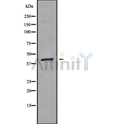 Western blot analysis SERPINB6 using K562 whole cell lysates