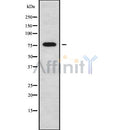 DF9896 at 1/100 staining Mouse liver tissue by IHC-P. The sample was formaldehyde fixed and a heat mediated antigen retrieval step in citrate buffer was performed. The sample was then blocked and incubated with the antibody for 1.5 hours at 22¡ãC. An HRP conjugated goat anti-rabbit antibody was used as the secondary