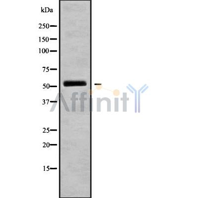 Western blot analysis SH2D4A using K562 whole cell lysates