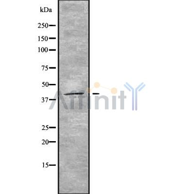 Western blot analysis of extracts from various samples, using STAC3 Antibody.
 Lane 1: 293 treated with blocking peptide.
 Lane 2: 293;
 Lane 3: HUVEC;
 