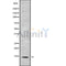 DF9906 at 1/100 staining Human liver tissue by IHC-P. The sample was formaldehyde fixed and a heat mediated antigen retrieval step in citrate buffer was performed. The sample was then blocked and incubated with the antibody for 1.5 hours at 22¡ãC. An HRP conjugated goat anti-rabbit antibody was used as the secondary