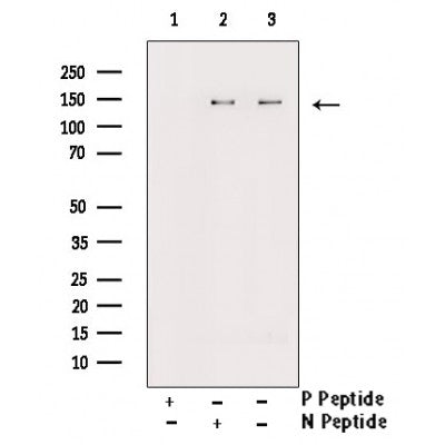 AF3156 staining HepG2 by IF/ICC. The sample were fixed with PFA and permeabilized in 0.1% Triton X-100,then blocked in 10% serum for 45 minutes at 25¡ãC. The primary antibody was diluted at 1/200 and incubated with the sample for 1 hour at 37¡ãC. An  Alexa Fluor 594 conjugated goat anti-rabbit IgG (H+L) Ab, diluted at 1/600, was used as the secondary antibod