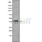 Western blot analysis of extracts from Rat  spleen, using SH3GL3 Antibody. The lane on the left was treated with blocking peptide.
